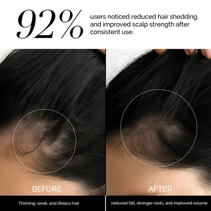 La Chevelure Anti Hair Loss Treatment