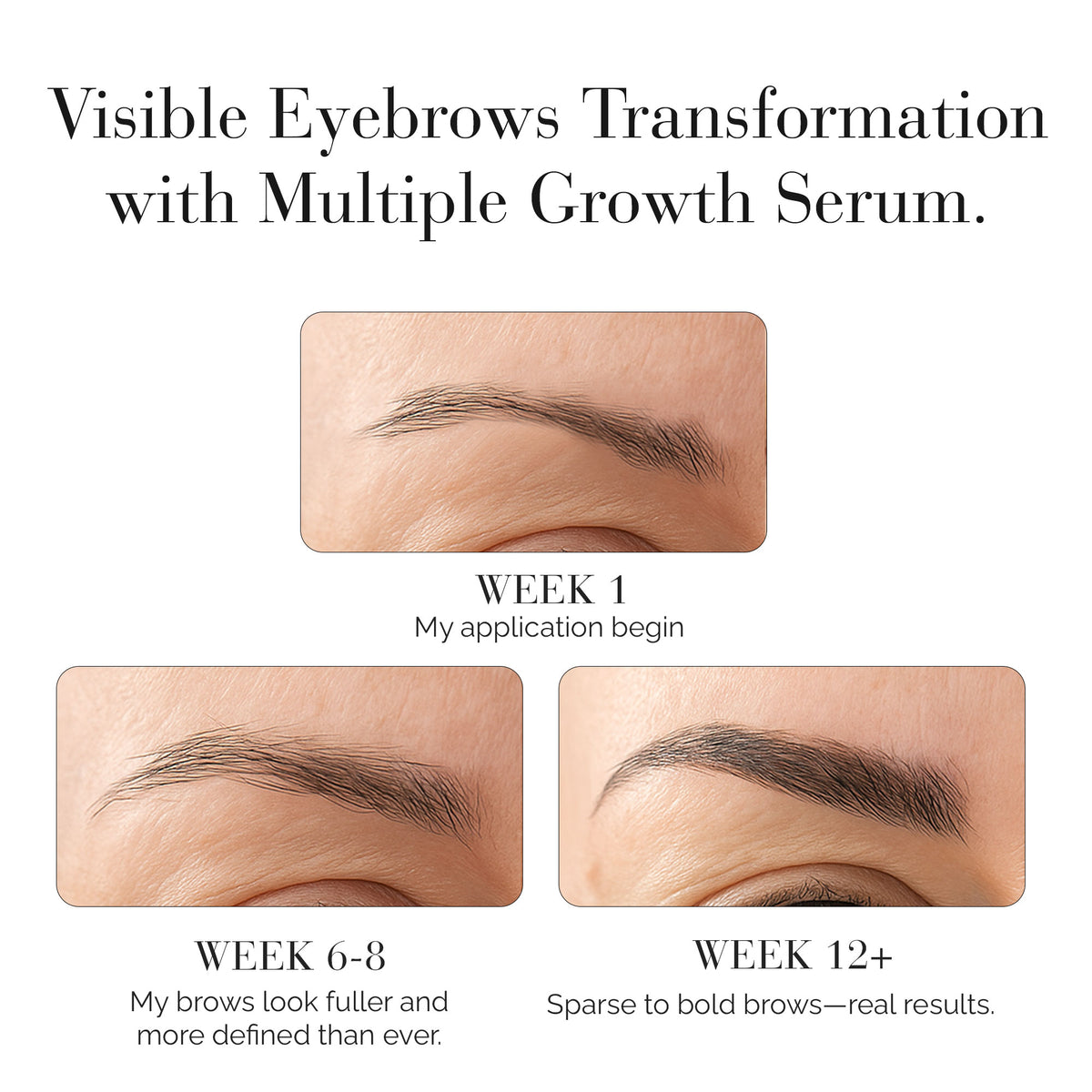 Multiple Growth Serum for Lash, Brow & Hair