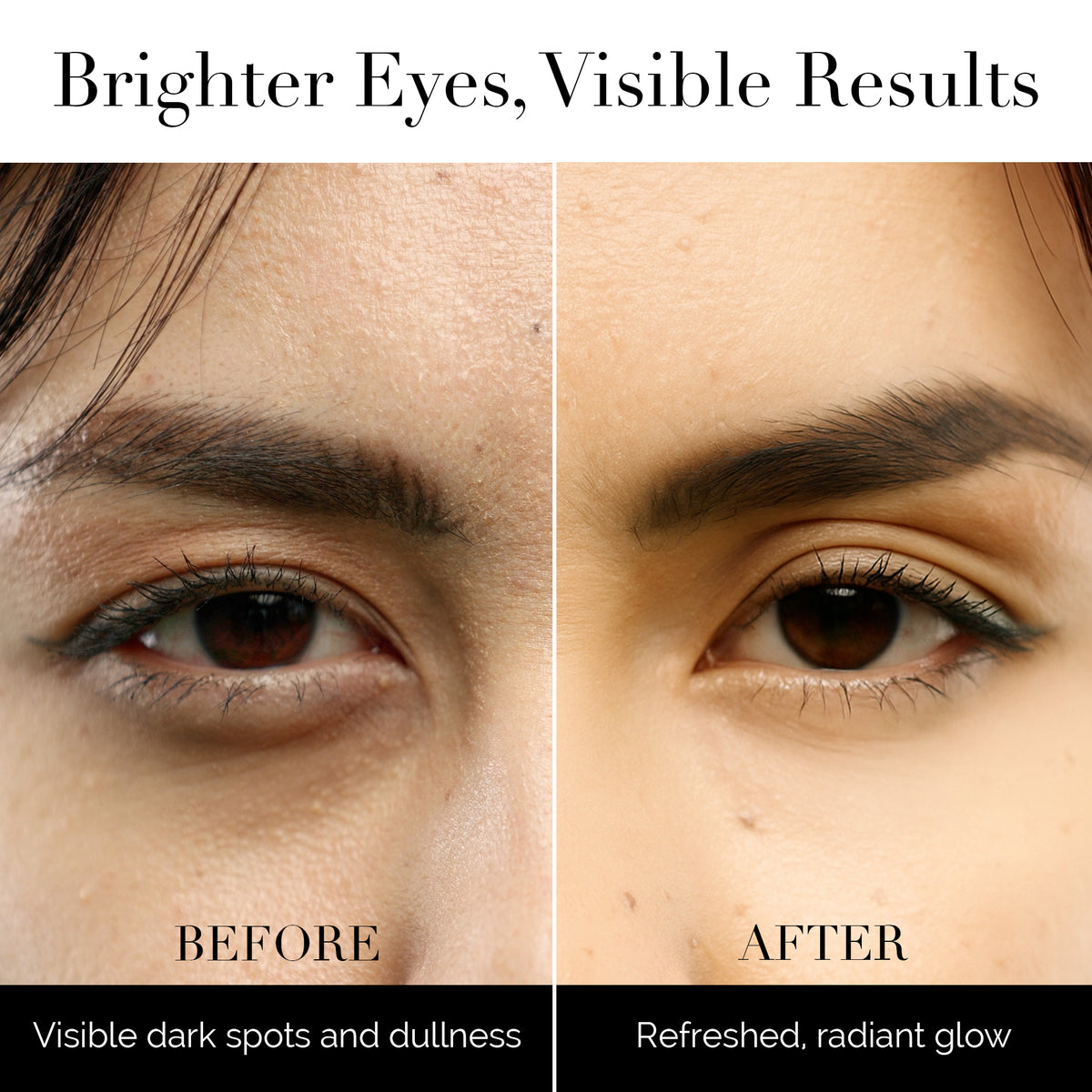 Vitamin C Eye Cream